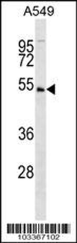 KIST (KIS) Antibody (N-term)