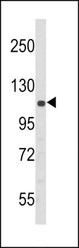 PERK Antibody (N-term Q163)