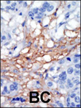 PIP5KI gamma (PIP5K1G) Antibody (C-term)
