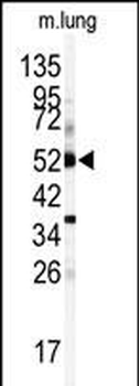 CYP1A1 Antibody (Center)