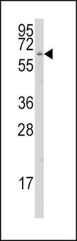 CYP1A1 Antibody (C-term)