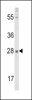 FGF10 Antibody (C-term)