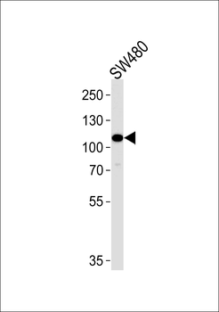 MAP3K9 Antibody (N-term)