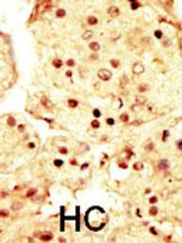 MAP3K9 Antibody (N-term)