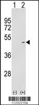 MAP2K2 Antibody (S222)