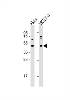 MAP2K2 Antibody (S222)
