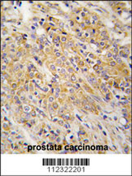 MAP2K2 Antibody (S222)