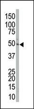 MEK2 (MAP2K2) Antibody (Center)