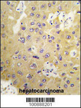 SGK3 Antibody (N-term)