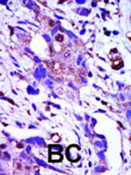PLK1 Antibody (C-term)