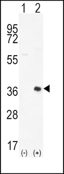 PIM2 Antibody (C-term)