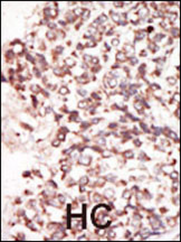 PIM2 Antibody (C-term)