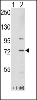 PAK1 Antibody (T423)