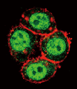 PAK1 Antibody (T423)