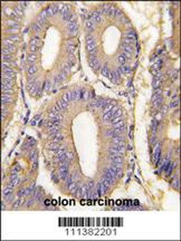 PAK1 Antibody (T423)