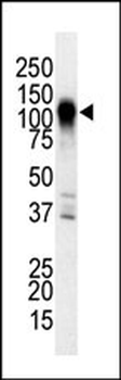 MEKK6 Antibody (C-term)