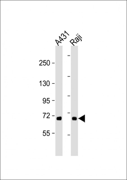 MAP3K5 Antibody(T842)