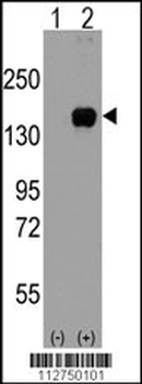 ASK1 (MEKK5/MAP3K5) Antibody (S966)