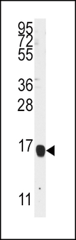ALOX5AP Antibody (Center)