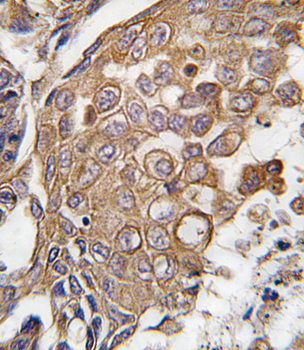 ALOX5AP Antibody (Center)