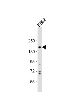 PHLPP1 Antibody (N-term)