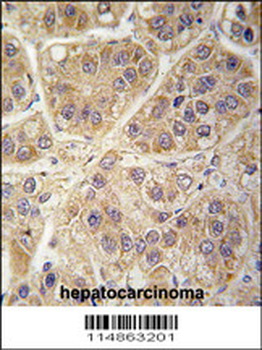 SARS2 Antibody (Center)