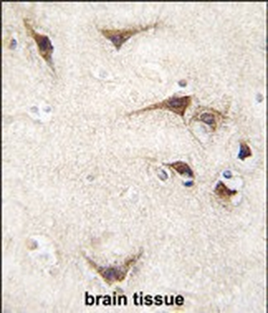 SARS Antibody (C-term)