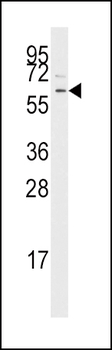TGF Beta Receptor I Antibody (Center)