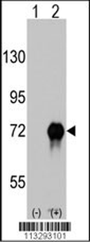 RAF1 Antibody (S621)