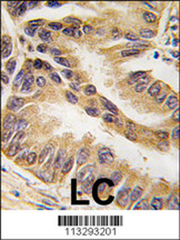 RAF1 Antibody (S621)