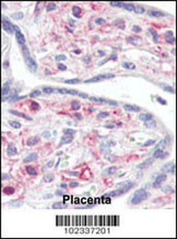 IRAK Antibody (C-term)