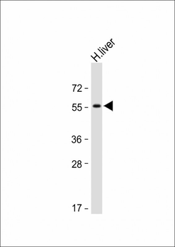 Activin A Receptor Type IB (ACVR1B) Antibody (N-term)