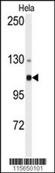ACTN4 Antibody (N-term)