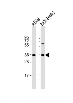 CTGF Antibody (C-term)