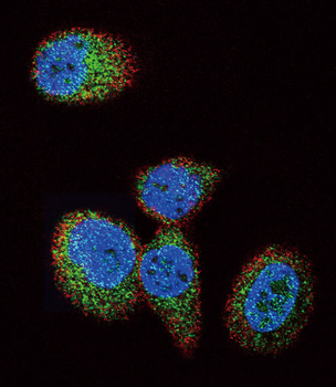 HRAS Antibody (Center)
