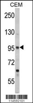 SEMA3A Antibody (Center)
