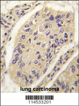 GHRH Antibody (N-term)