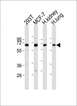 TIEG Antibody (N-term)