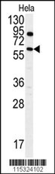 ANTXR1 Antibody (Y382)