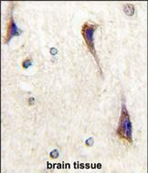 CDK5R1(p35) Antibody (C-term)