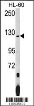 PUM1 Antibody (N-term)