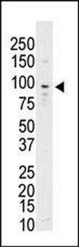 TYRO3 Antibody (C-term)
