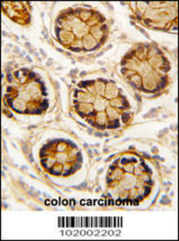 PDGFRL Antibody (C-term)