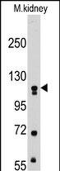 MUSK Antibody
