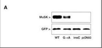 MUSK Antibody (N-term)