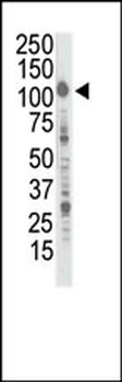 Insulin Receptor R Antibody (C-term)