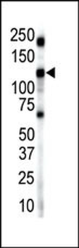 Insulin Receptor R Antibody (N-term)