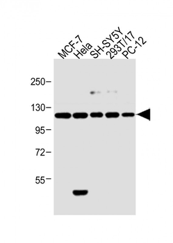 Insulin Receptor R Antibody (N-term)