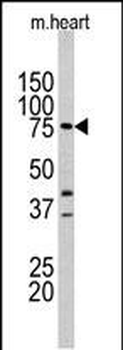 Lactoferrin (LTF) Antibody (Center)