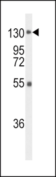 FGFR1 Antibody